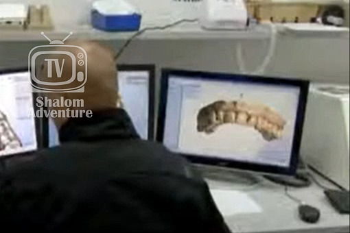 Israeli Company Gives Orthodontics New Bite